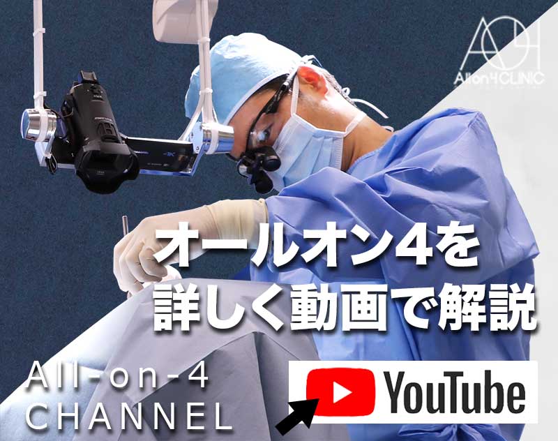 オールオン4クリニック公式youtubeチャンネル